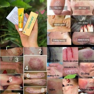 KEM BÔI DA THUẦN MỘC