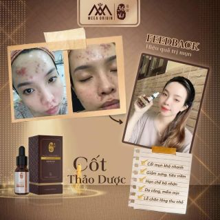 SERUM CỐT HUYẾT THANH 36 VỊ THẢO DƯỢC