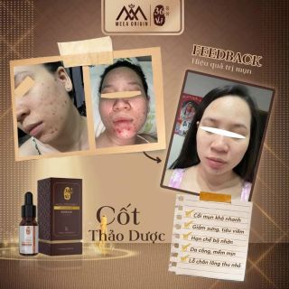 SERUM CỐT HUYẾT THANH 36 VỊ THẢO DƯỢC
