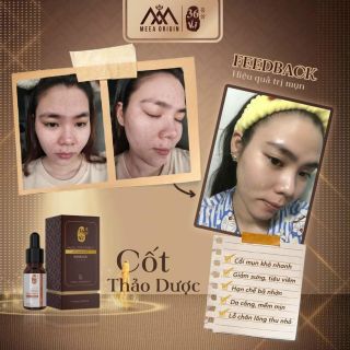 SERUM CỐT HUYẾT THANH 36 VỊ THẢO DƯỢC