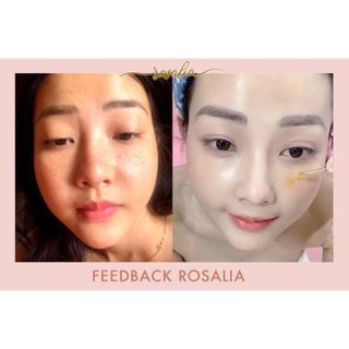 Serum Dr. Be SERUM NEA ROSALIA _ Dưỡng Trắng _ Phục Hồi _ Căng Bóng Da _Lọ 20ml