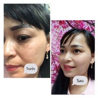 Kem Dưỡng Trắng Da Mặt Dr.Be Night Cream _ Trắng Sáng _ Căng Bóng _ Ngăn Ngừa Nám Tối Đa Nhất Lọ 30ml