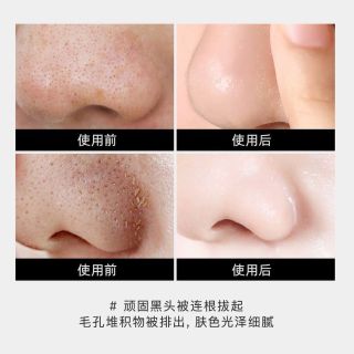 Tuýp lột mụn mũi Hisses 20g
