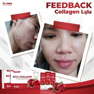 collagen lựu đỏ DR Halee