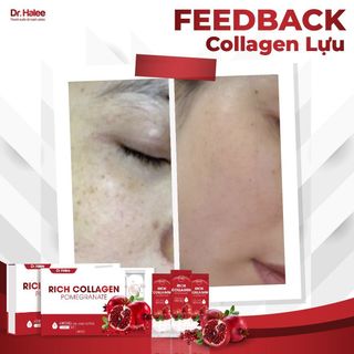 collagen lựu đỏ DR Halee