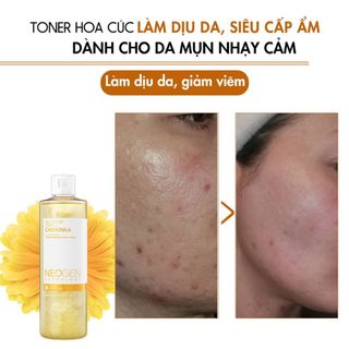 Nước Hoa Hồng Chiết Xuất Hoa Cúc Cấp Ẩm, Dịu Da Neogen Dermalogy Real Flower Calendula Toner 300ml giá sỉ