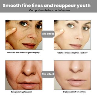 Serum EELHOE CAVIAR điều trị da nám, ko đều màu , sẹo rổ , giúp bạn có làn da trắng sáng