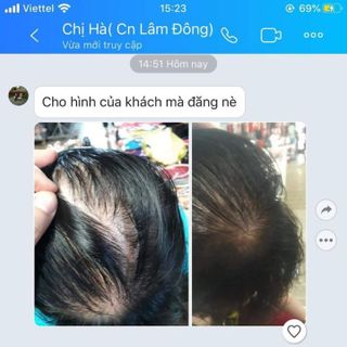 Thuốc trị hói đầu - rụng tóc -Mọc tóc Sâm hương Nhu