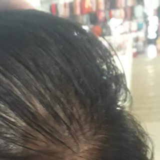 Thuốc trị hói đầu - rụng tóc -Mọc tóc Sâm hương Nhu