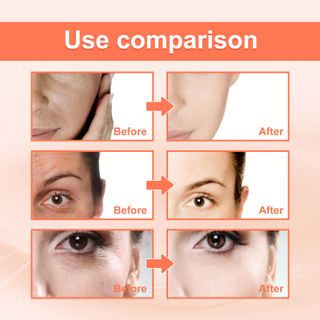 Serum EELHOE Skin VC chống lão hoá, phục hồi da chảy xệ, giup da căng min , sáng , cùng tàn nhan (50ml)