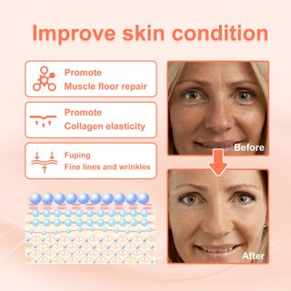 Serum EELHOE Skin VC chống lão hoá, phục hồi da chảy xệ, giup da căng min , sáng , cùng tàn nhan (50ml)