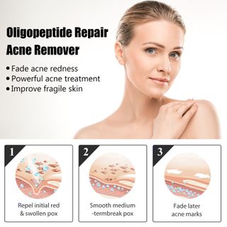 Serum Oligopeptide Repair Lipuild trị mụn , trị nám chuyên sau (10ml)