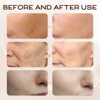 SERUM VitaminE chuyên phục hồi , dưỡng da chuyên sâu được các spa chuyên dùng (30ml)