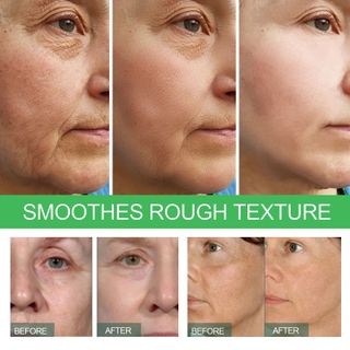 Serum Nha Đam Daily Serum Anti-Aging giup trẻ hoá da, chống nhăn ,da sáng , chống chảy xệ (20ml)