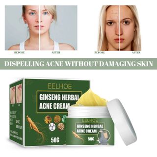 Kem Sâm chuyên trị các loại mụn Ginseng Herbai Acne Cream (50g)