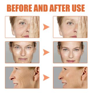 Serum Dưỡng da JaySuing loại bỏ mụn cám , phục hồi da lão hoá (30ml)