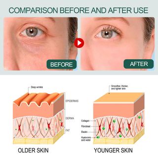 Serum Dưỡng Da Chuyên Sâu Anti-Aging Daily OUHOE (30ml)