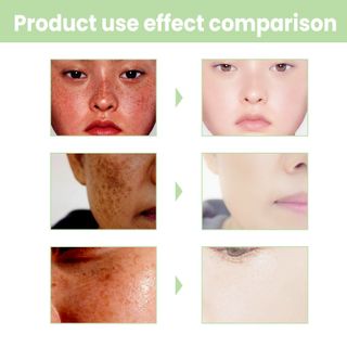 Kem Dưỡng chuyên đặc Trị nám , tàn nhan, mụn , da sạm , se kít lỗ chân lông , giúp da sáng min. Và chắc khoẻ (30g)