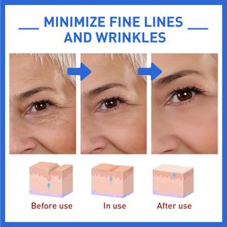 Serum Chuyên Cải thiện da chuyên sâu BOTOX Stock SoluTion (30ml)