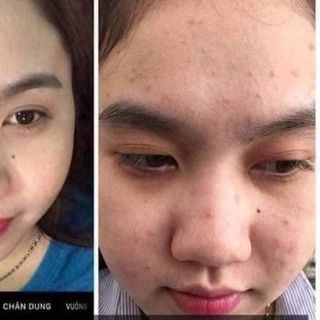 Kem Meiduzi Nhật Bản