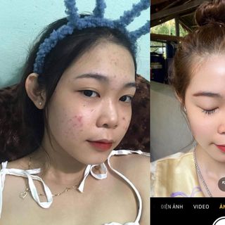 Kem Meiduzi Nhật Bản
