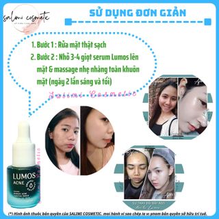 Serum Mụn LUMOS ACNE (Mẫu Plus) Hỗ Trợ Trị Mụn, Làm Mờ Vết Thâm Do Mụn Để Lại, Đều Màu Da, Dưỡng Da Khoẻ Căng Bóng, Se Khít Lỗ Chân Lông | Dung Tích 5 ml - HÀNG CHÍNH HÃNG