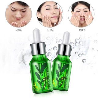 Tinh chất serum trà xanh Rorec giúp da trắng sáng và chống lão hóa ngừa mụn hiệu quả 15ml