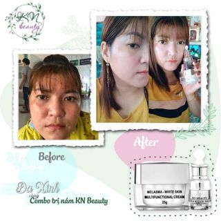 KEM KN BEAUTY CHÍNH HÃNG