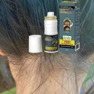 Mọc tóc FEG