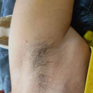 Combo Wax lông shiny kèm mỡ trăn triệt lông