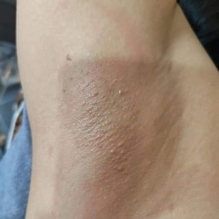 Combo Wax lông shiny kèm mỡ trăn triệt lông