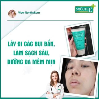 SỮA RỬA MẶT 3 TRONG 1 SMOOTH E BABYFACE FOAM 30ML