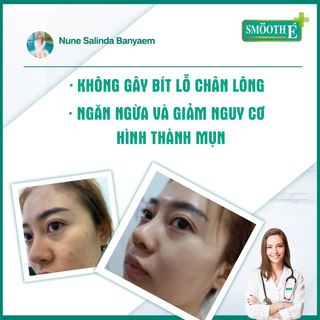 SỮA RỬA MẶT 3 TRONG 1 SMOOTH E BABYFACE FOAM 30ML