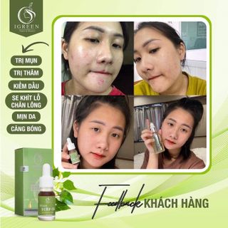 Serum Trị Mụn Diếp Ca