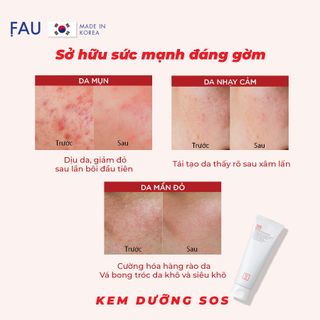Kem dưỡng Phục Hồi SOS