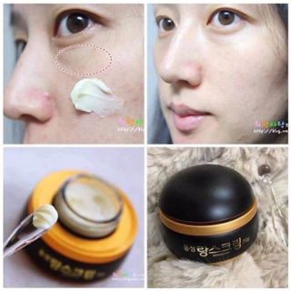 Kem Trị Nám Dongsung Mẫu Mới Nhất