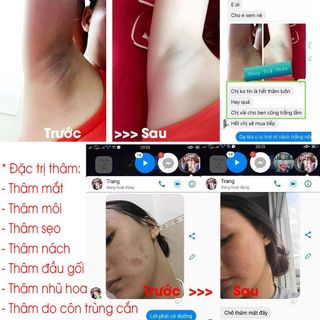 Tinh Dầu Giảm Thâm Cao Cấp Linh Hương, Tinh_dầu_trị_thâm Linh Hương