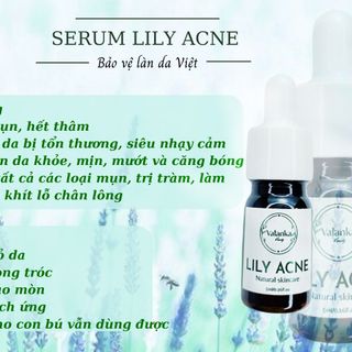 Serum trị mụn từ thiên nhiên Lily Acne - Valanka giá sỉ