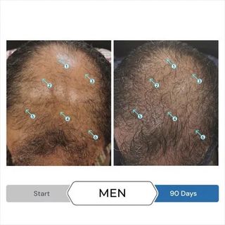 Spectrl.UHF 60ml - Serum chống rụng tóc, kích mọc tóc dành cho Nam.