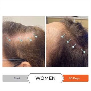 REVITA STIMULATING CONDITIONER 925ML - DẦU XẢ GIẢM GÃY RỤNG, KÍCH THÍCH MỌC TÓC