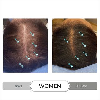 SPECTRAL.DNC-S 60ml - Serum giảm gãy, rụng, bạc tóc, kích thích mọc tóc.