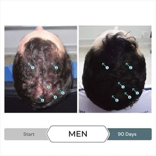 SPECTRAL.F7 60ml - Serum giảm gãy, rụng, kích thích mọc tóc.