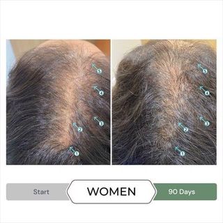 REVITA®.CBD CONDITIONER  205ML - DẦU XẢ CHỐNG OXY HÓA, GIẢM GẪY RỤNG, KÍCH THÍCH MỌC TÓC.