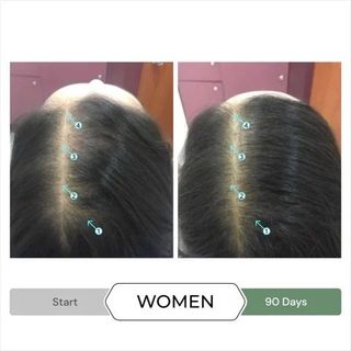 REVITA®.CBD SHAMPOO 205ML - DẦU GỘI CHỐNG OXY HÓA, GIẢM GẪY RỤNG, KÍCH THÍCH MỌC TÓC