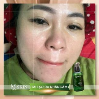 Tái tạo mqskin