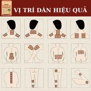 Cao Dán Cơ Xương Khớp Cải Thiện Các Tình Trạng Đau Đầu, Đau Dây Thần Kinh, Đau Vai Gáy, Bong Gân - Calen Nature Farm