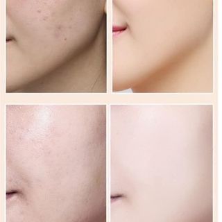 Kem Nền Che Khuyết Điểm L - Da Hoạ Tiết Dạng Thỏi Đầu Nấm Dưỡng Ẩm