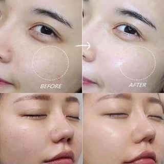 Serum Hỗ Trợ Giảm Nám Trắng Da Dongsung Miskos Whitening Serum Mist 100ml.