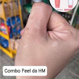 Combo 2 tuýp peel da body retinol hmstore giá sỉ