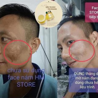Face nám hmstore giá sỉ bán buôn